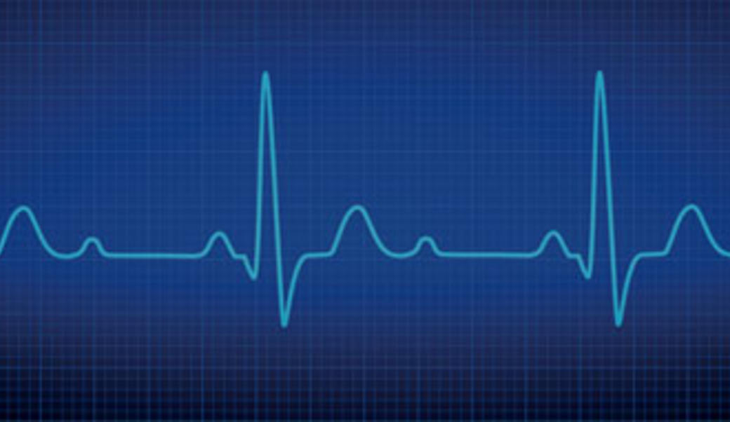 EKG readout